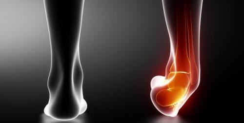 Какие виды упражнений наиболее эффективны для быстрого восстановления организма после травмы. Какие травмы самые частые при занятиях спортом?