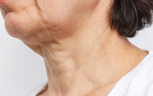 Бросил курить последствия по дням. Влияние табачного дыма на кожу