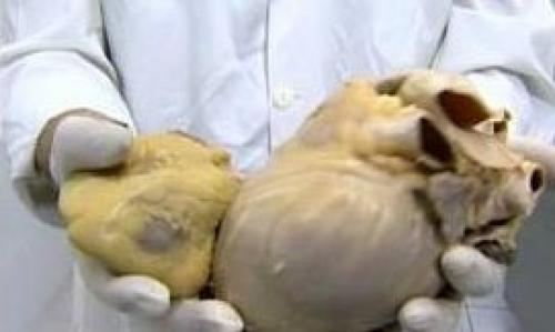 Влияние 2 стаканов пива спустя 12 часов: что нужно знать 07