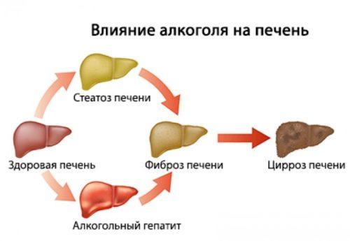 Срок восстановления печени после отказа от алкоголя. Влияние алкоголя на печень 05 Срок восстановления печени после отказа от алкоголя. Влияние алкоголя на печень 05